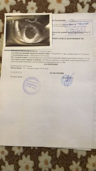 Про узи,посмотрите пожалуйста
