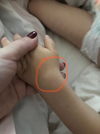Белое пятно на руке у сына