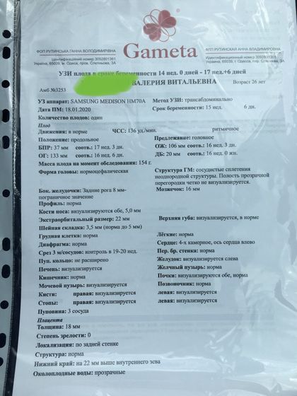 УЗИ 16 недель