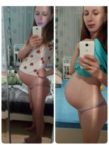 Опустился ли живот?