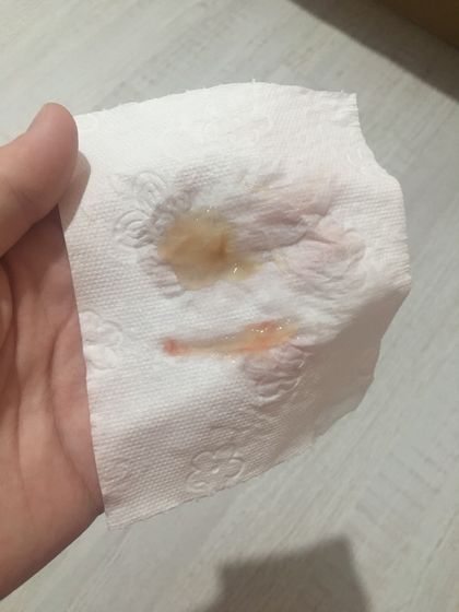 Брезгливые мимо ?? второе фото