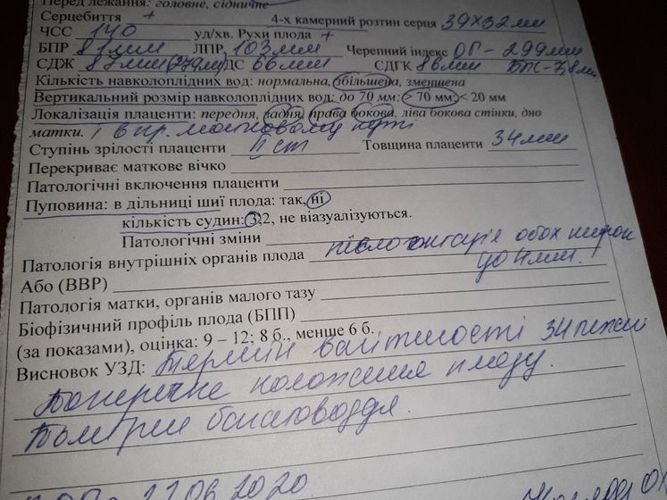 Девочки помогите расшифровать что