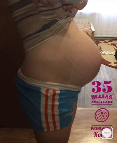 Бегемотик или наши 35 неделек ??