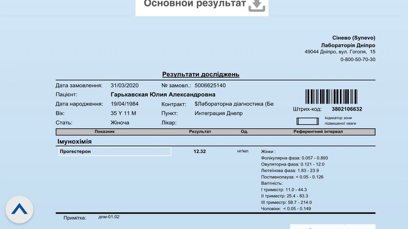 Подскажите пришли анализы прогестерона,
