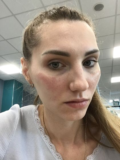 РОЗАЦЕА !!!! 🆘🆘🆘🆘🆘🆘🆘🆘🆘🆘🆘Девочки подскажите у кого может было ?