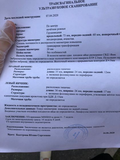 Вакуум