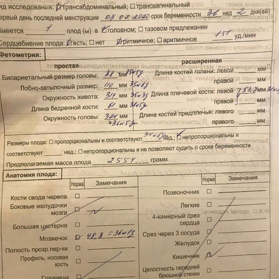 Узи укорочение длинных трубчатый костей 36 недель