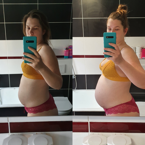 30Vs35 недель🥰