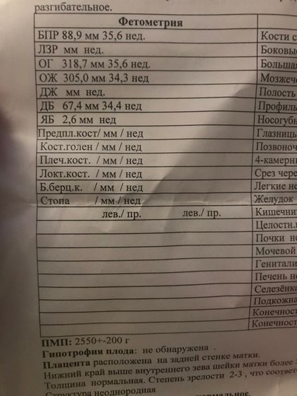Узи 36 недель