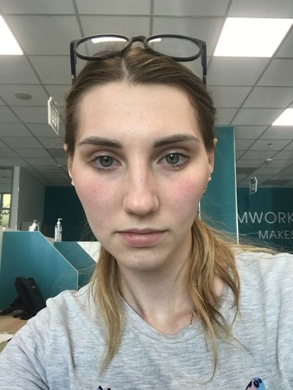 РОЗАЦЕА !!!! 🆘🆘🆘🆘🆘🆘🆘🆘🆘🆘🆘Девочки подскажите у кого может было ?