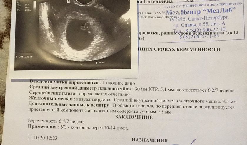 Хороший УЗИСТ СПБ