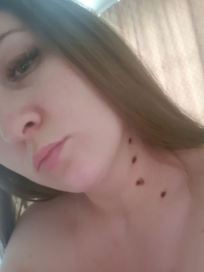 Чувствую запах своего горелого тела 😥