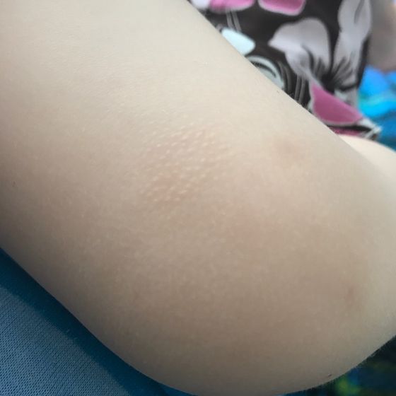 Что это может быть ?