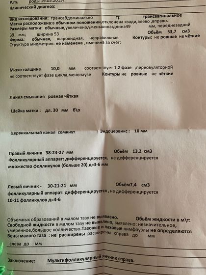 Узи