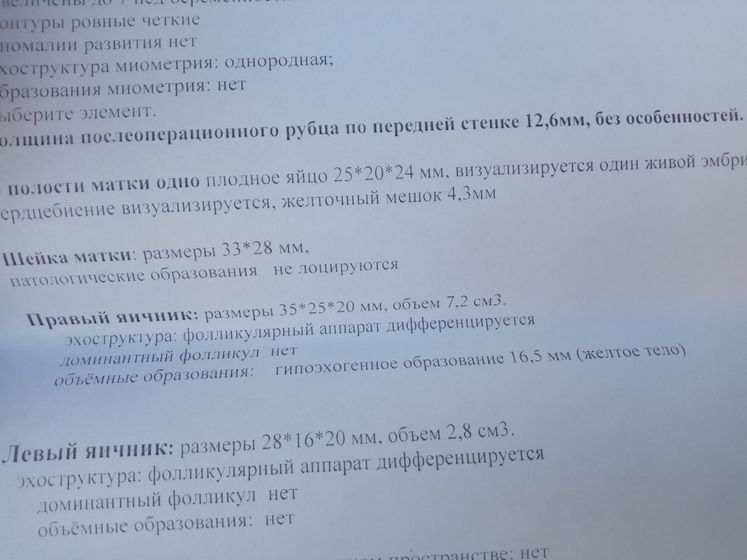 Реву... От счастья...Не могу успакоится.... Сегодня хоть усну спакойно