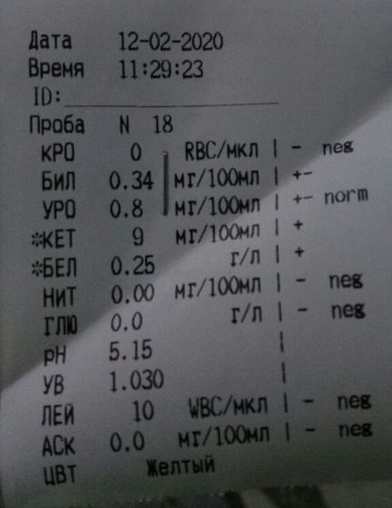 Анализ мочи.