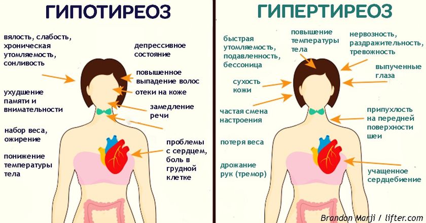 Из гипер в гипотериоз😒