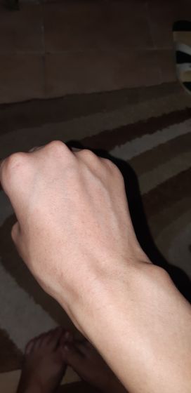 Это точно корь?