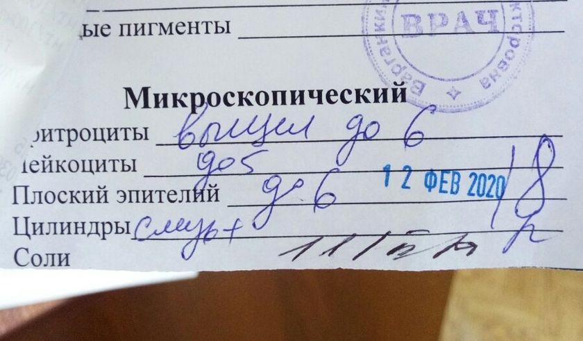 Анализ мочи.