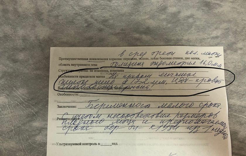 Жёлтое тело. ЦДК кровоток