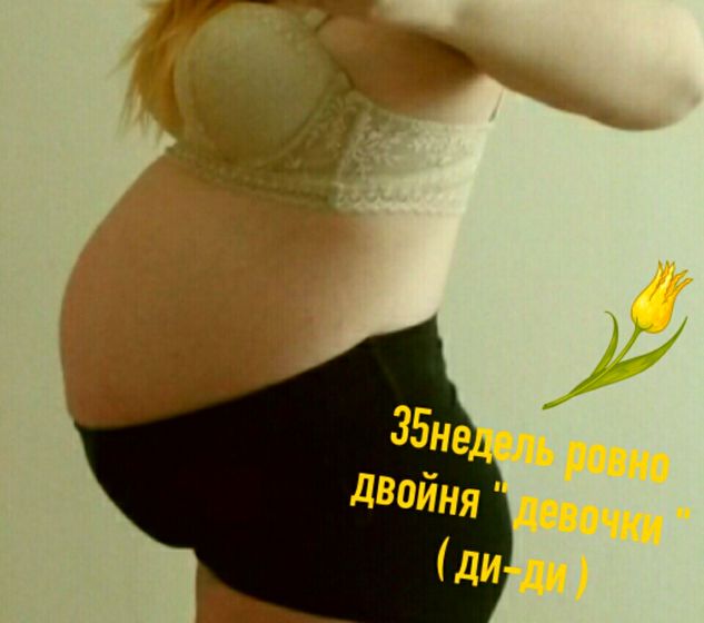 Нам сегодня ровно 35 недель 😊 