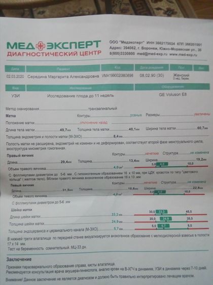 УЗИ