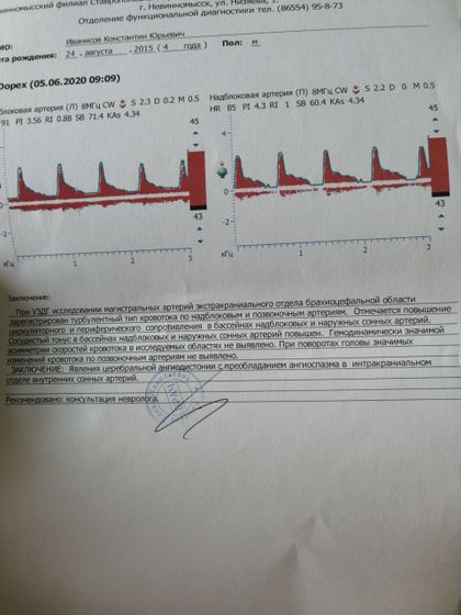 Узи сосудов шеи, результат
