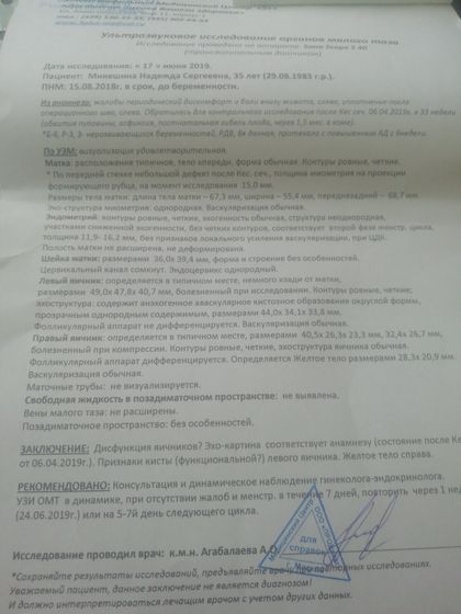 Узи для знающих мою историю,