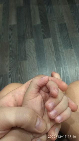 Западает пальчик