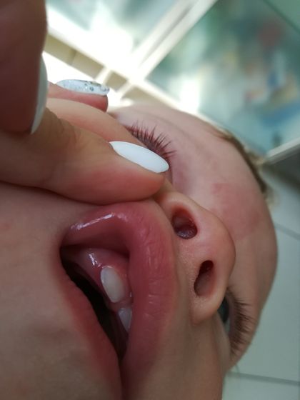 Мамочки подскажите, у нас