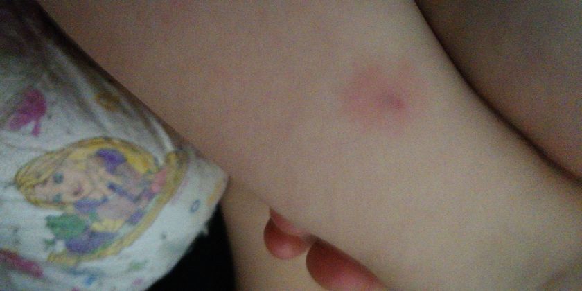 Вчера делали прививку от