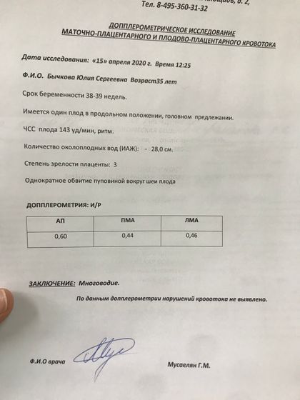 38-39 недель, многоводие