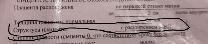 2й скрининг. Подозрение на инфекцию