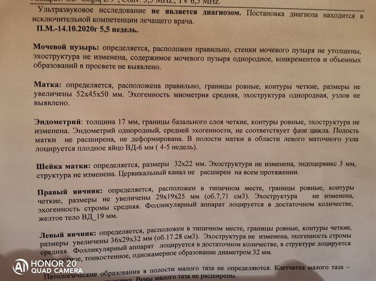 Нашли в углу матки!!! Это как так? У кого так было?