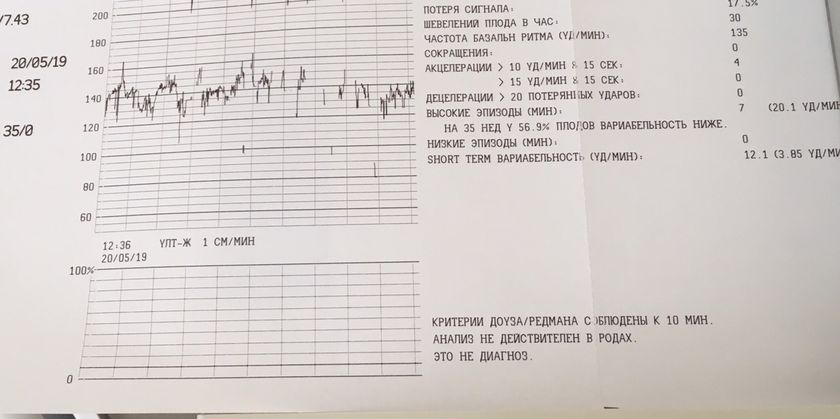 КТГ! В чем суть?!