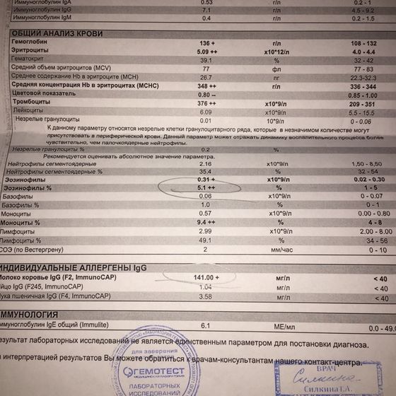 Аллергия на кошек кто сталкивался ?