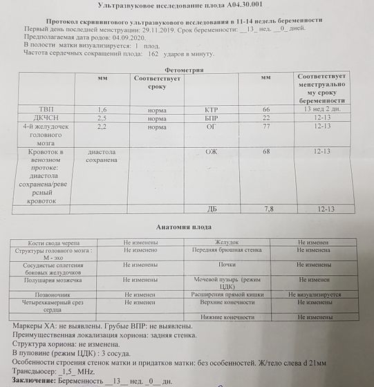Амниоцентез