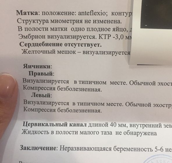 Вторая зб((