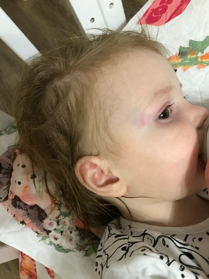 Ударилась виском об угол