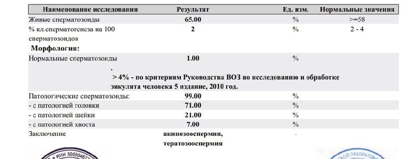 Спермограмма.