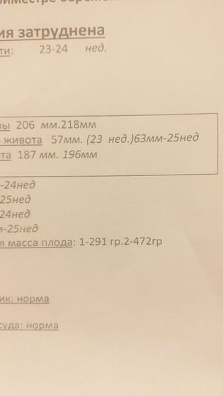 Вес у двойни