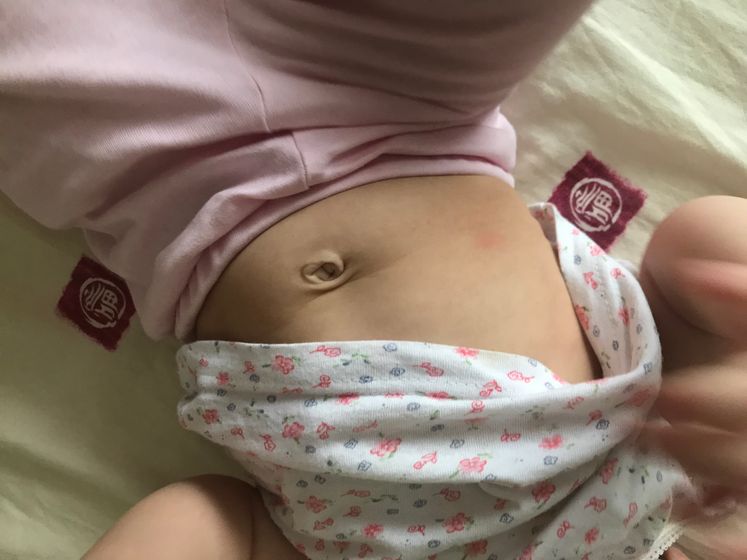 Аллергия? Дерматит?
