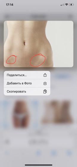 Покалывания