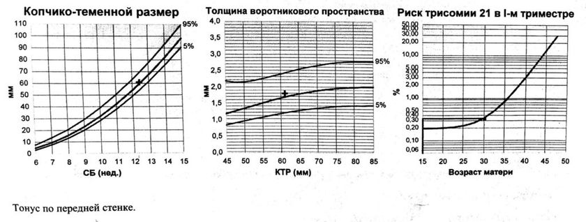 1 Скрининг, Сосновая 11