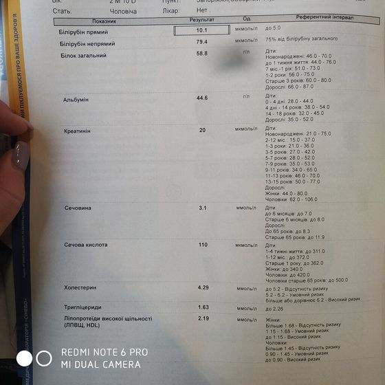 Высокий билирубин в 2.5 мес.