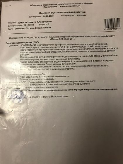 Энцефалограмма