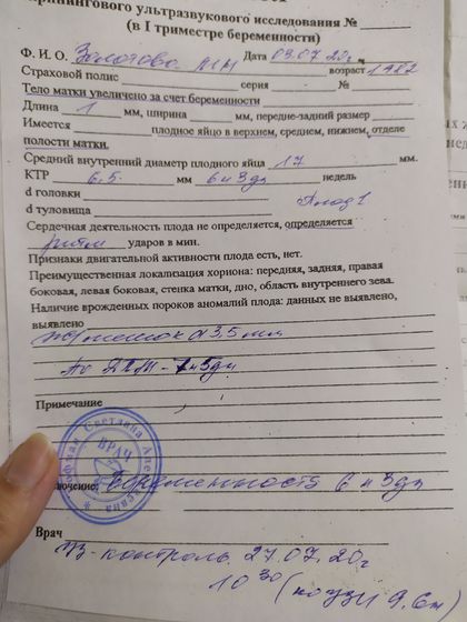 Девочки, ходила на УЗИ