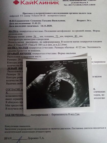 Узи❤️