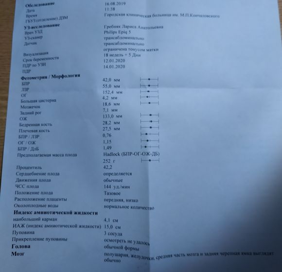 2 скрининг. У нас будет сын!