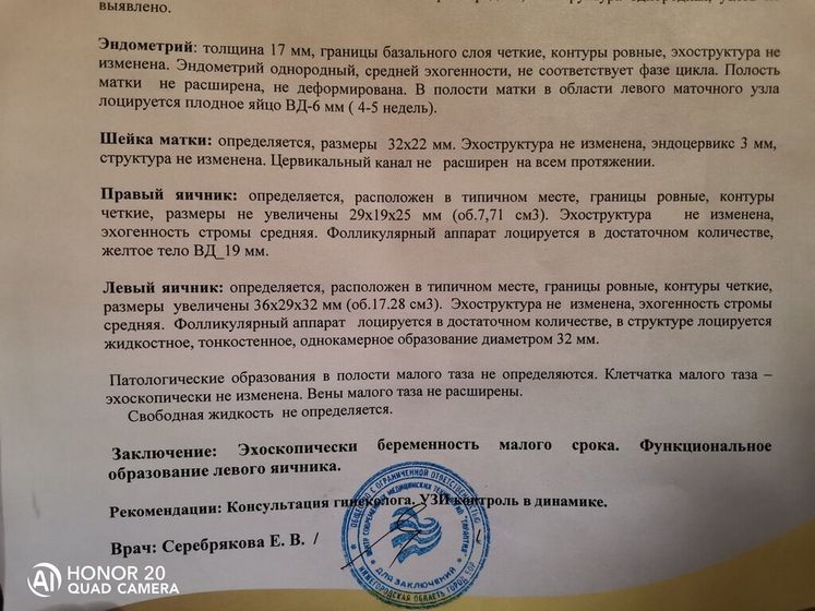 Нашли в углу матки!!! Это как так? У кого так было?